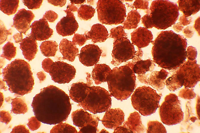 ilots-de-Langerhans